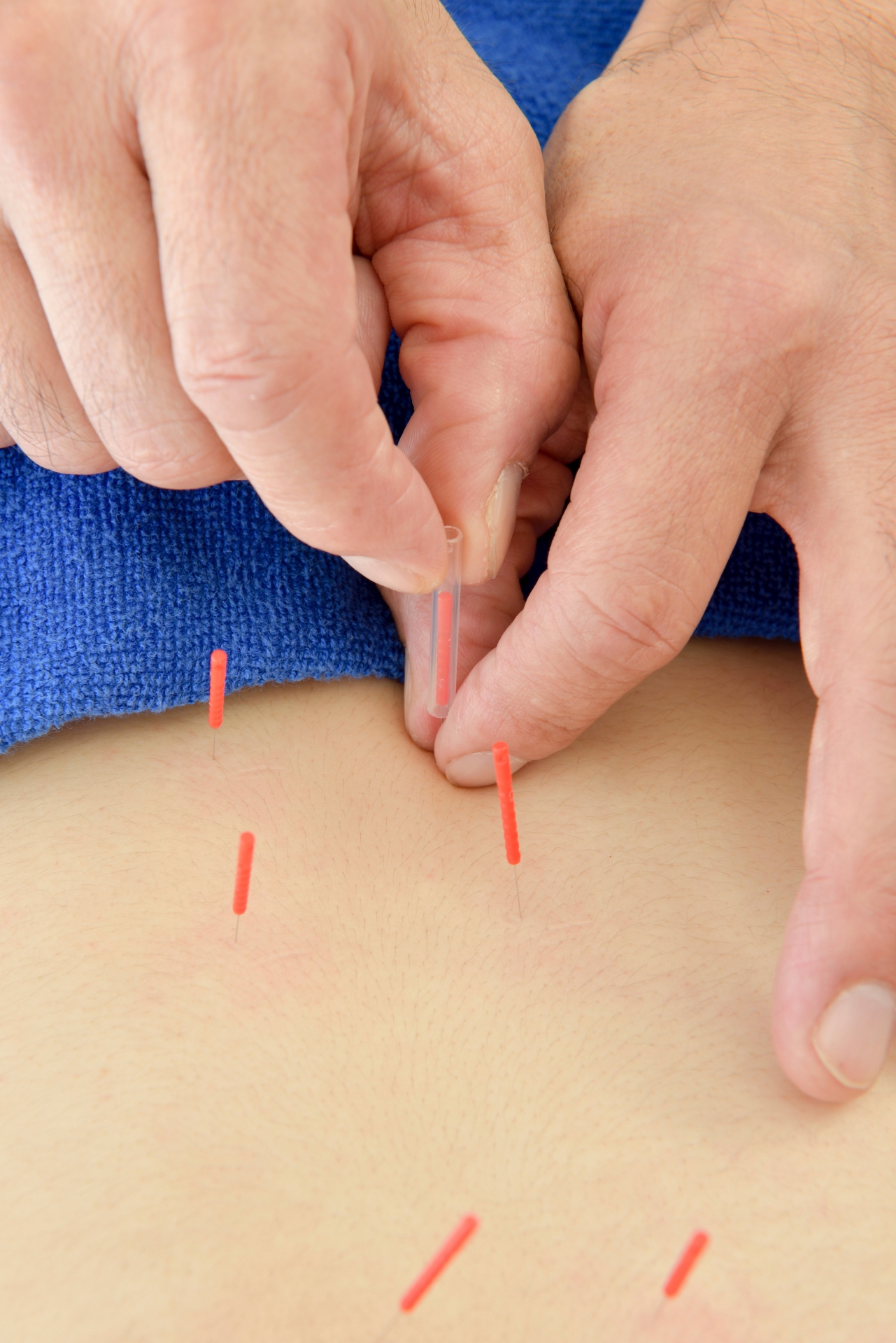 Chinese Medicine Doctor | Holistic Healing with Traditional Wisdom